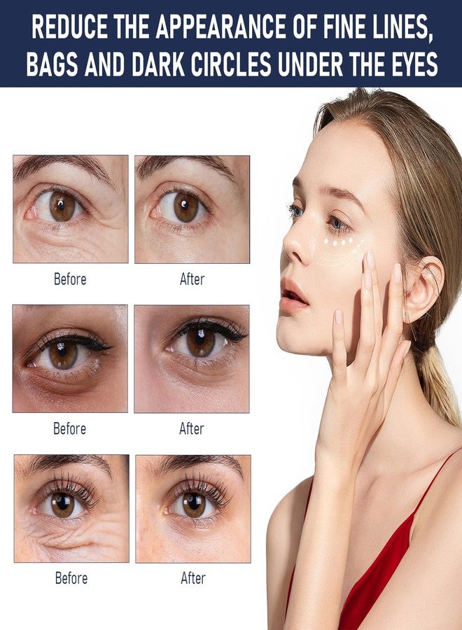 Traboto Rapid Reduction Eye Serum, Advanced Formula Instant Eye Serum, Anti Aging Serum Visibly Reduces Under-eye Bags, Nourishing Eye Serum, Suitable For All Skin Type (2Pcs) - Image 5
